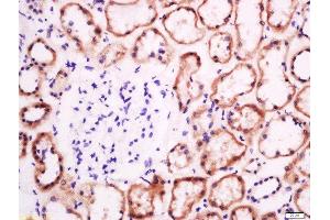 Paraformaldehyde-fixed, paraffin embedded human kidney tissue, Antigen retrieval by boiling in sodium citrate buffer(pH6) for 15min, Block endogenous peroxidase by 3% hydrogen peroxide for 30 minutes, Blocking buffer (normal goat serum) at 37°C for 20min, Antibody incubation with Rabbit Anti-EphB2 R Polyclonal Antibody, Unconjugated  at 1:200 overnight at 4°C, followed by a conjugated secondary and DAB staining (EphB2 R (AA 101-200) antibody)