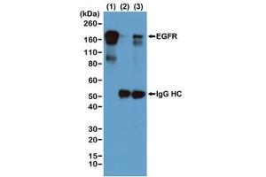IP of EGF-treated human A431 cells by the recombinant Phosphotyrosine antibody at 1:1000 and blotted with an anti-EGFR mAb. (Recombinant Phosphotyrosine antibody)