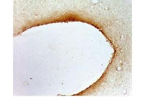 Rat hypothalamus tissue was stained by anti-AQ-27 (401-433) (Mouse) Serum at 1:50 (QRFPR antibody  (AA 401-433))