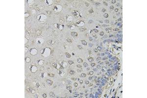Immunohistochemistry of paraffin-embedded human esophagus using AMPD1 antibody (ABIN5995393) (40x lens). (AMPD1 antibody)