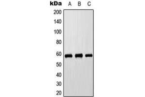 Western blot analysis of Cytochrome P450 8B1 expression in HEK293T (A), Raw264. (CYP8B1 antibody  (Center))