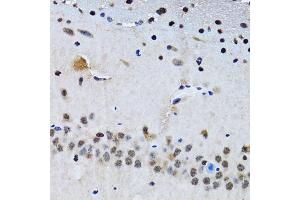Immunohistochemistry of paraffin-embedded mouse brain using BIRC7 antibody. (BIRC7 antibody)
