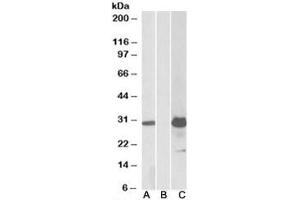 Western blot testing of HEK293 lysate overexpressing human KCTD11-FLAG with KCTD11 antibody (1ug/ml) in lane A and anti-FLAG (1/5000) in lane C. (KCTD11 antibody)