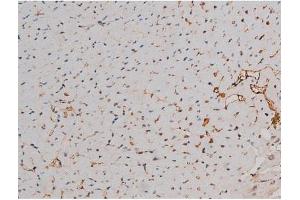 ABIN6267437 at 1/200 staining Mouse heart tissue sections by IHC-P. (RPS6KB1 antibody  (pThr229))