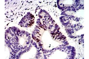 Immunohistochemistry (IHC) image for anti-MutS Homolog 6 (E. Coli) (MSH6) antibody (ABIN969293)