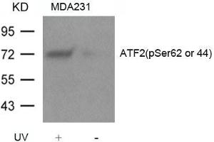 Western blot analysis of extracts from MDA231 cells untreated or treated with UV using ATF2(Phospho-Ser62 or 44) Antibody. (ATF2 antibody  (pSer62))