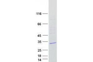 Transmembrane Protein 41A (TMEM41A) protein (Myc-DYKDDDDK Tag)