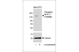 Western blot analysis of lysates from NIH/3T3 cell line, untreated or treated with λ phosphatases, 30 min, using Phospho-MYPT1 (Thr696) Antibody (upper) or Tubulin (lower). (PPP1R12A antibody  (pThr696))