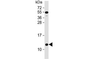 Western blot testing of human heart lysate with NDUFA2 antibody at 1:2000.