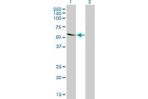 Western Blot analysis of TROVE2 expression in transfected 293T cell line by TROVE2 monoclonal antibody (M03), clone 1F2. (TROVE2 antibody  (AA 1-100))