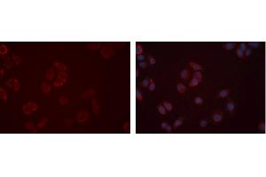 ABIN6277362 staining Hela cells by IF/ICC.