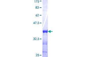 CMPK2 Protein (AA 151-250) (GST tag)