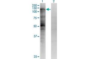 Western Blot analysis of MSH2 expression in transfected 293T cell line by MSH2 monoclonal antibody (M04), clone 4F11. (MSH2 antibody  (AA 835-934))