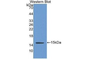 Western Blotting (WB) image for anti-Complement Factor B (CFB) (AA 270-388) antibody (ABIN2118419) (Complement Factor B antibody  (AA 270-388))