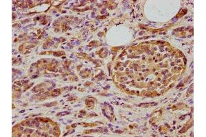 Immunohistochemistry (IHC) image for anti-DnaJ (Hsp40) Homolog, Subfamily A, Member 3 (DNAJA3) (AA 86-184) antibody (ABIN7150498)