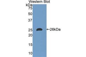 Western blot analysis of the recombinant protein. (Apolipoprotein M antibody)
