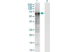 Western Blot analysis of PLS3 expression in transfected 293T cell line by PLS3 monoclonal antibody (M01), clone 5B9. (Plastin 3 antibody  (AA 1-630))