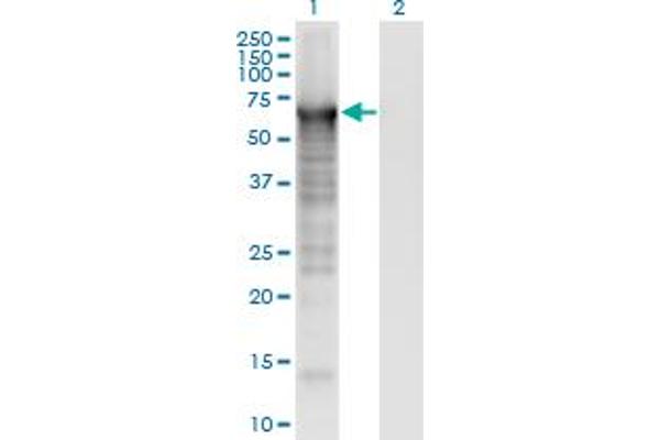 Plastin 3 anticorps  (AA 1-630)