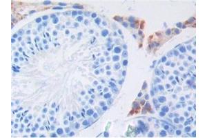 Detection of FGF6 in Mouse Testis Tissue using Polyclonal Antibody to Fibroblast Growth Factor 6 (FGF6)