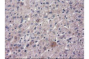 Immunohistochemical staining of paraffin-embedded Human liver tissue using anti-HAO1 mouse monoclonal antibody.