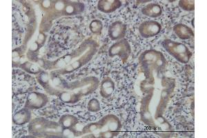 Immunoperoxidase of monoclonal antibody to STAM on formalin-fixed paraffin-embedded human small Intestine.