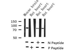 Western blot analysis of Phospho-PKC alpha (Thr638) expression in various lysates (PKC alpha antibody  (pThr638))