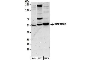 Western Blotting (WB) image for anti-Protein Phosphatase 2, Regulatory Subunit B, beta (PPP2R2B) (AA 25-75) antibody (ABIN7450596)