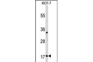 Western blot analysis of DSTN Antibody (Center) (ABIN653136 and ABIN2842712) in MCF-7 cell line lysates (35 μg/lane).