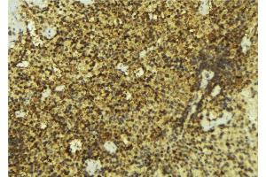 ABIN6276911 at 1/100 staining Mouse pancreas tissue by IHC-P.