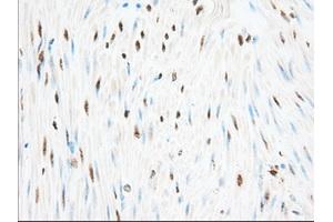 Immunohistochemistry (IHC) image for anti-Glucose-6-Phosphate Dehydrogenase (G6PD) antibody (ABIN2722394)
