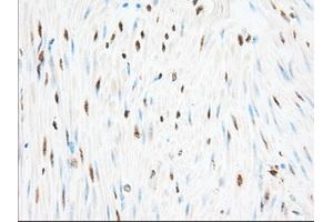 Immunohistochemical staining of paraffin-embedded Human pancreas tissue using anti-H6PD mouse monoclonal antibody.