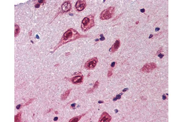 Ubiquilin 1 antibody  (AA 290-339)