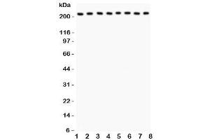Western blot testing of Integrin alpha 5 antibody and Lane 1:  rat brain (ITGA5 antibody  (AA 787-992))