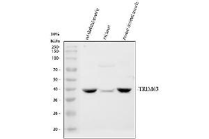 Western blot analysis of TRIM63 using anti-TRIM63 antibody (ABIN7600489).