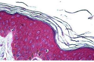 Human Skin: Formalin-Fixed, Paraffin-Embedded (FFPE) (UBE2D2 antibody  (AA 1-95))