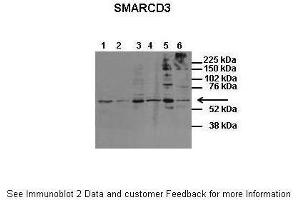 Host:  Rabbit  Target Name:  SMARCD3  Sample Type:  Human Fetal Brain  Antibody Dilution:  1. (SMARCD3 antibody  (N-Term))