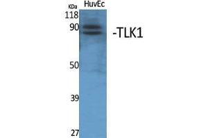Western Blotting (WB) image for anti-Tousled-Like Kinase 1 (TLK1) (Internal Region) antibody (ABIN3177735) (TLK1 antibody  (Internal Region))
