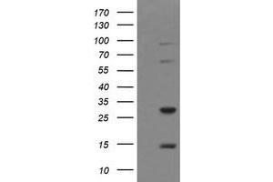 Image no. 2 for anti-Tripartite Motif Containing 38 (TRIM38) (AA 1-265) antibody (ABIN1490686) (TRIM38 antibody  (AA 1-265))