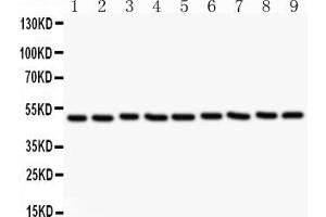 Anti-CSK Picoband antibody, All lanes: Anti CSK  at 0. (CSK antibody  (AA 2-204))