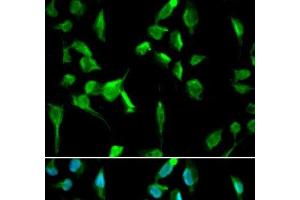 Immunofluorescence analysis of A549 cells using TOPBP1 Polyclonal Antibody (TOPBP1 antibody)