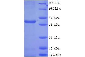 SDS-PAGE (SDS) image for SCO2 Cytochrome C Oxidase Assembly Protein (SCO2) (AA 43-266) protein (His-SUMO Tag) (ABIN4976176) (SCO2 Protein (AA 43-266) (His-SUMO Tag))