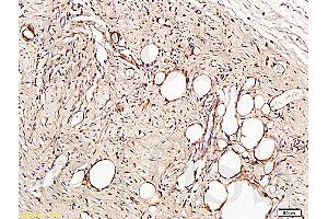 Immunohistochemistry (IHC) image for anti-Platelet/endothelial Cell Adhesion Molecule (PECAM1) (AA 601-680) antibody (ABIN669006)