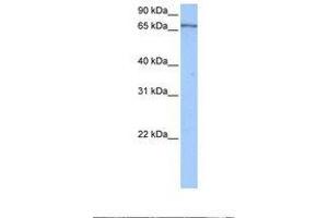 Image no. 1 for anti-Poly(A) Binding Protein, Cytoplasmic 4 (Inducible Form) (PABPC4) (AA 432-481) antibody (ABIN6737931)