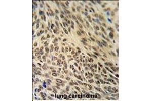 Immunohistochemistry (Paraffin-embedded Sections) (IHC (p)) image for anti-X-Ray Repair Complementing Defective Repair in Chinese Hamster Cells 6 (XRCC6) (AA 521-548), (C-Term) antibody (ABIN651280)