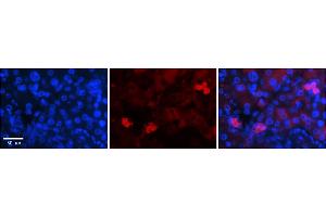 Immunohistochemistry (IHC) image for anti-Nuclear Respiratory Factor 1 (NRF1) (Middle Region) antibody (ABIN2775850)