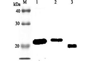 Western blot analysis using anti-RBP4 (rat), pAb  at 1:2'000 dilution. (RBP4 antibody)