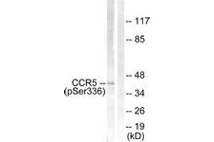 Western blot analysis of extracts from Jurkat cells, using CCR5 (Phospho-Ser336) Antibody. (CCR5 antibody  (pSer336))