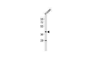 Anti-CNR2 Antibody (N-term) at 1:2000 dilution + human brain lysates Lysates/proteins at 20 μg per lane. (CNR2 antibody  (N-Term))