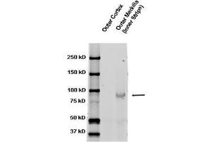 ENaC beta, rat kidney tissue. (SCNN1A antibody  (AA 617-638))
