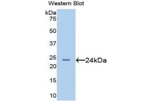 Western Blotting (WB) image for anti-Afamin (AFM) (AA 210-403) antibody (ABIN1077755) (Afamin antibody  (AA 210-403))
